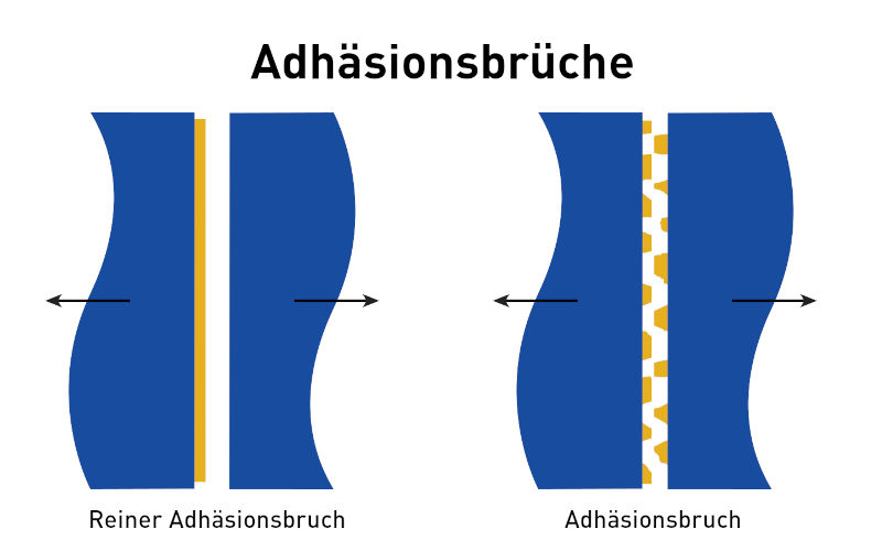 Versagen der Klebeverbindung: Adhäsionsbruch